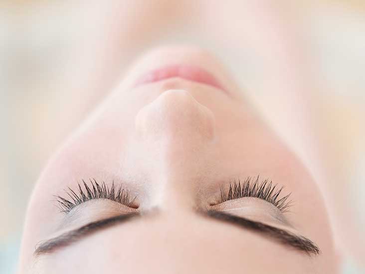 Peel with Hydroquinone